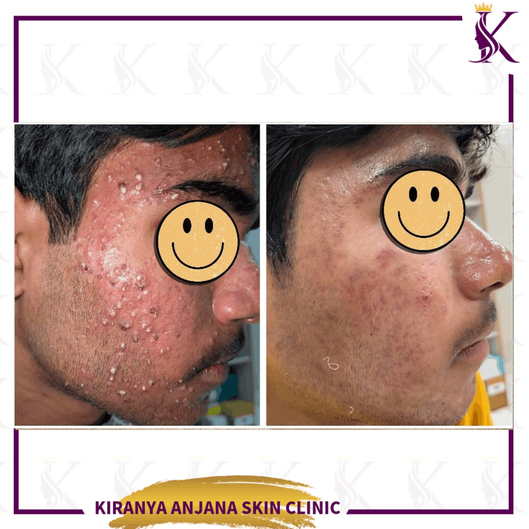 Untitled design (1) (1)