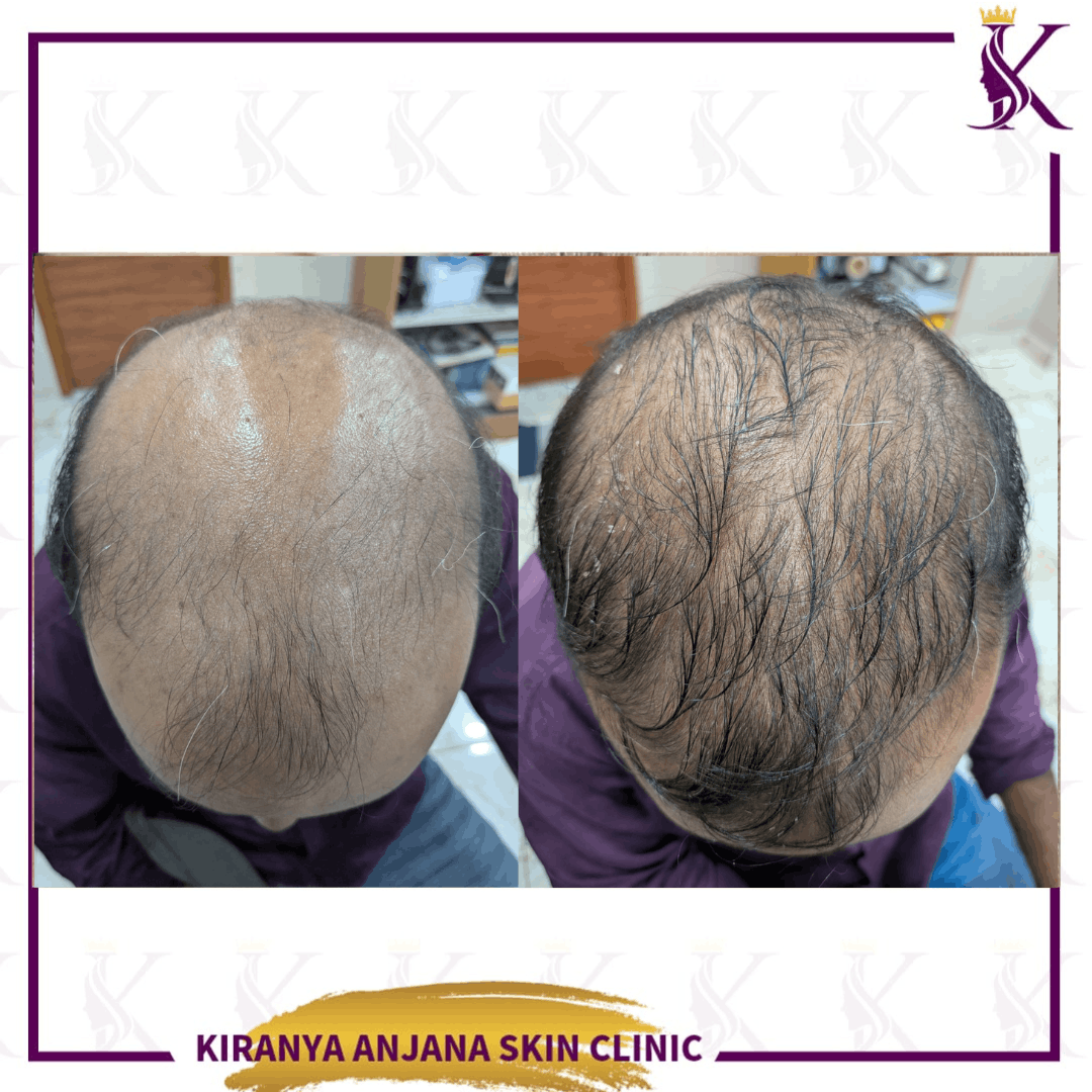 Untitled design (2) (1)