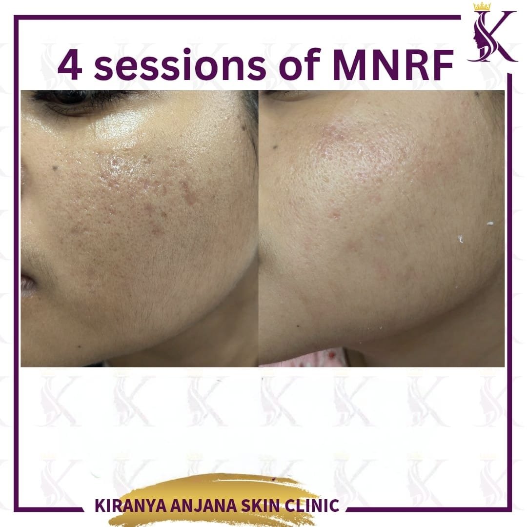 WhatsApp Image 2026-01-21 at 12.38.56 PM (1)